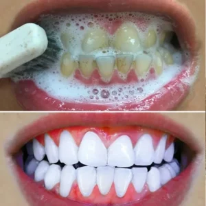 Teeth Whitening Products Tooth Mousse Tooth Stain Oral Gum Care Fresh Breath