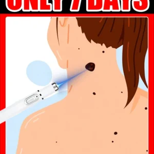 wart care tools,Hot selling blue light pen to solve body warts