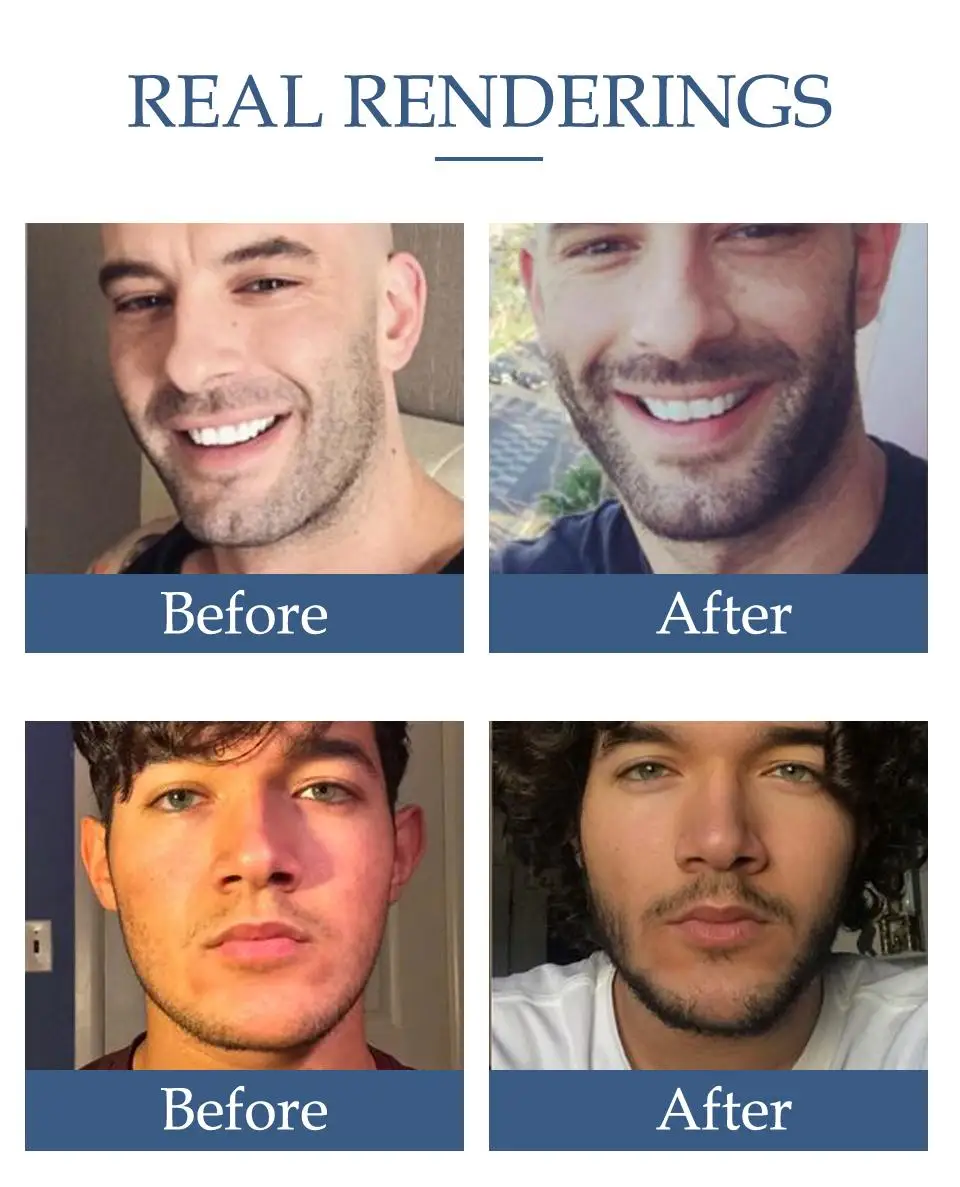 Men Natural Beard Growth Oil Moisturizing Smoothing Hair Growth Tools Dashing Gentlemen Beard Oil Conditioner Beard Care - Image 2